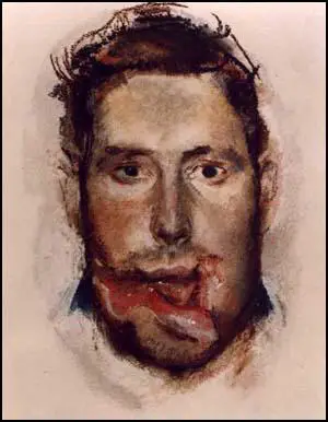 One of Henry Tonks drawings of a wounded soldier.